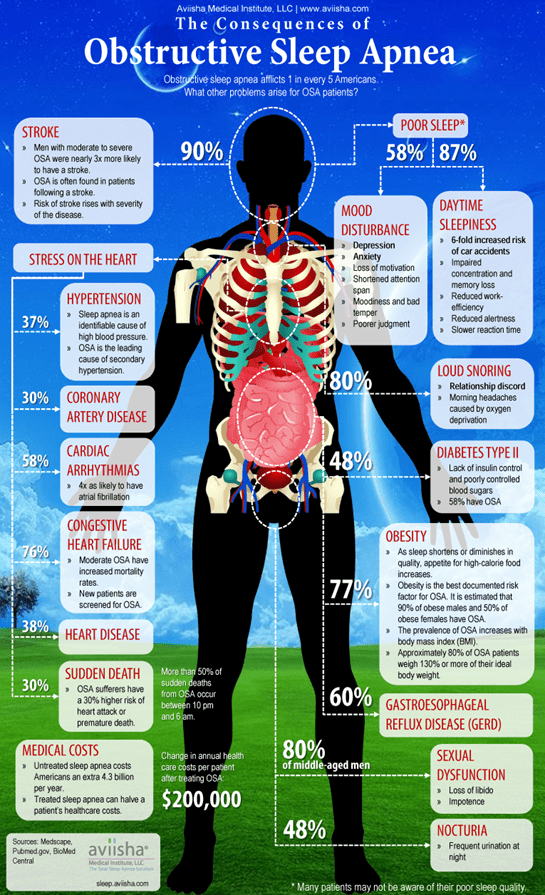 graphic with details of obstructive sleep apnea