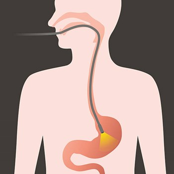 oral endoscope for endoscopy procedure