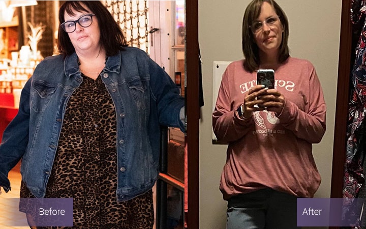 Ali's before and after picture