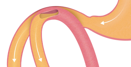 Mag-DI-Procedure-Step-4-1.png